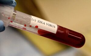 A gloved hand holds a test tube containing blood with a label that reads (+) ZIKA VIRUS, indicating a positive test result for the Zika virus.
