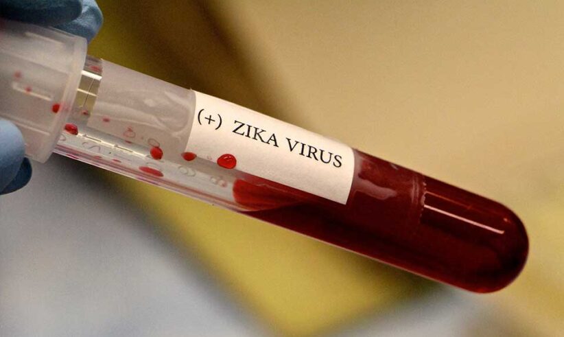 A gloved hand holds a test tube containing blood with a label that reads (+) ZIKA VIRUS, indicating a positive test result for the Zika virus.