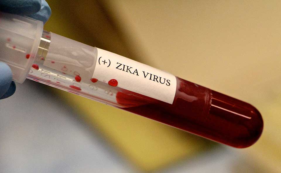 Zika Virus Positive Blood Test