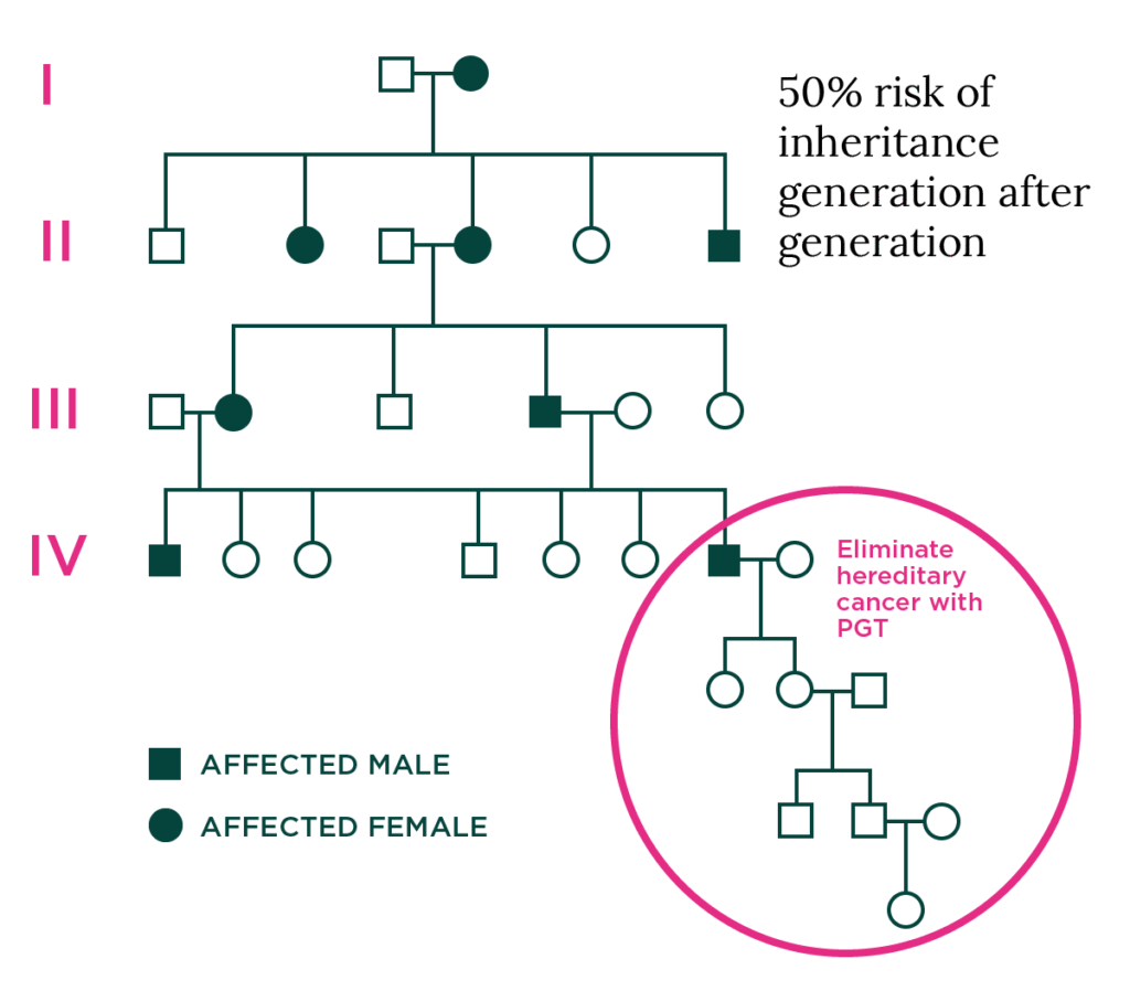 A pedigree chart showing inheritance of a hereditary cancer gene over four generations, with affected males (filled squares) and females (filled circles). A circle highlights the prevention of inheritance using PGT.
