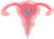 image of Intrauterine Insemination (IUI)