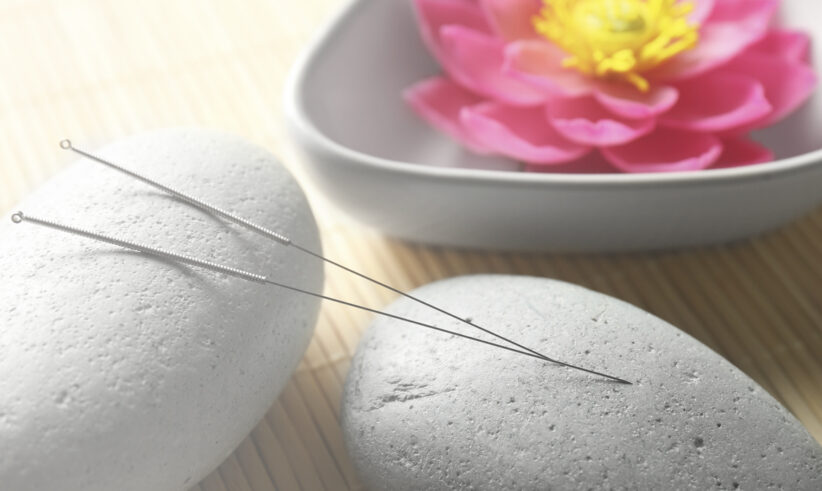 Two acupuncture needles rest on smooth gray stones, with a pink lotus flower in a white bowl in the background, creating a calm and serene spa-like setting.