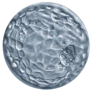 A close-up image of a blastocyst, showing a round, translucent structure with a slightly textured surface and a cluster of cells on one side.