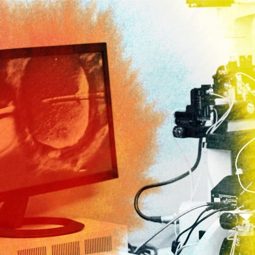 A computer monitor displays a magnified image of a cell, while scientific equipment, including a microscope, is set up beside it, bathed in red and yellow lighting effects.