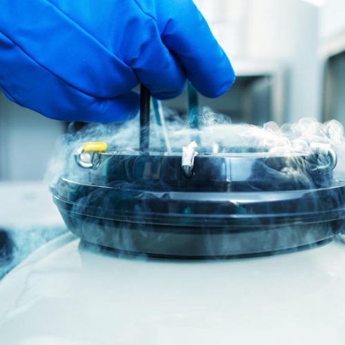 A gloved hand holds forceps over an open cryogenic container filled with liquid nitrogen, with cold vapors rising from the opening.