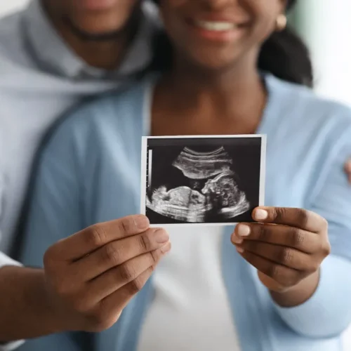 A smiling couple embraces and holds up an ultrasound image, suggesting excitement and anticipation for their expected baby. Their faces are partially out of focus, emphasizing the ultrasound photo.