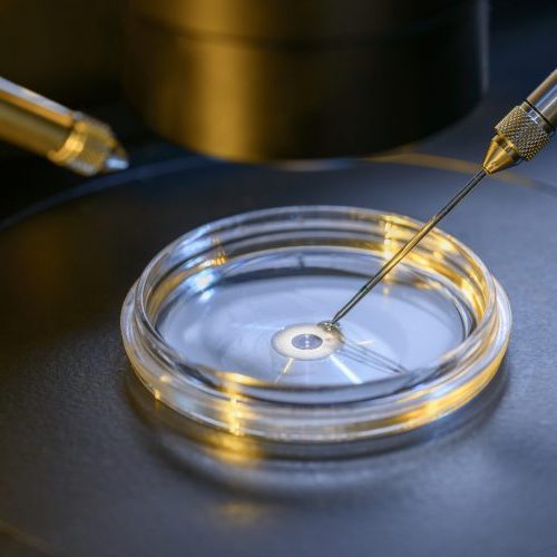 A close-up of a petri dish with a cell under a microscope, being manipulated by two fine-tipped pipettes or needles, representing a laboratory procedure such as in vitro fertilization or genetic research.