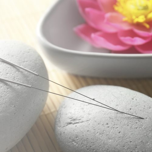 Two acupuncture needles rest on smooth gray stones, with a pink lotus flower in a white bowl in the background, creating a calm and serene spa-like setting.