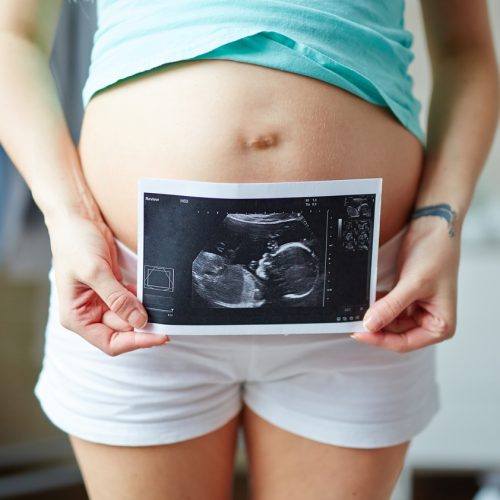 A pregnant person wearing a blue top and white shorts holds an ultrasound image in front of their bare belly, with the ultrasound showing a fetus. The background is softly blurred, focusing on the person.