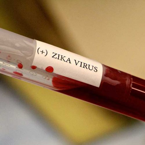 A gloved hand holds a test tube containing blood with a label that reads (+) ZIKA VIRUS, indicating a positive test result for the Zika virus.